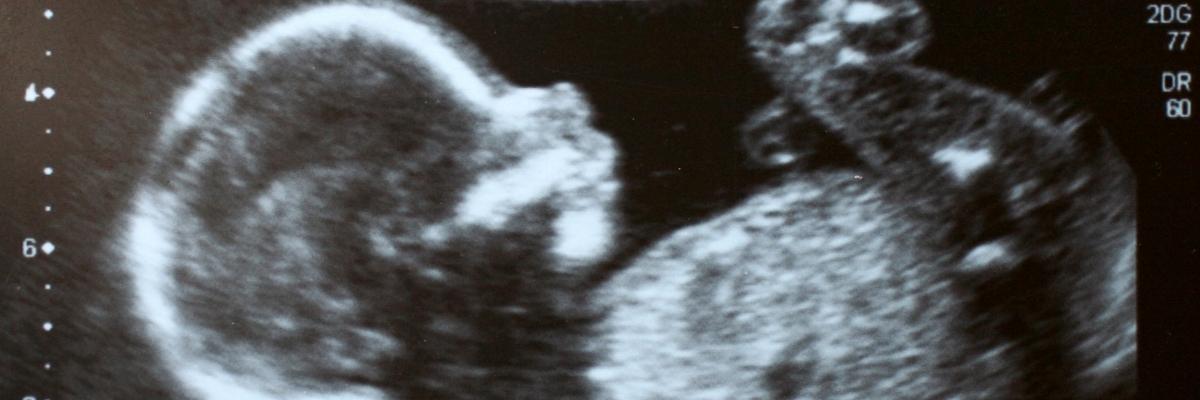 Estudo revela como idade da mãe e irmãos influenciam sexo do bebê